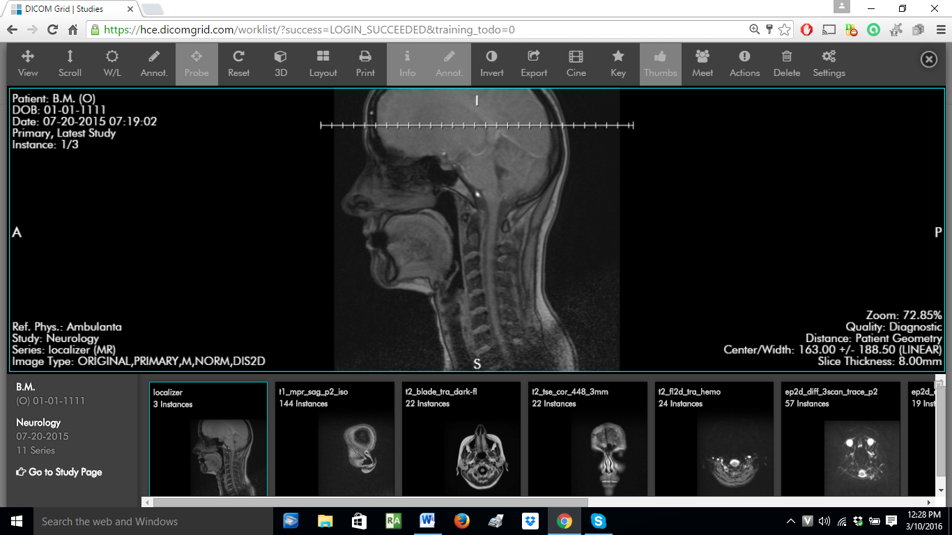 MRI